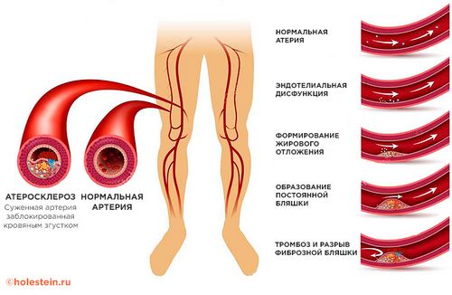 Узи сосудов (вен и артерий) нижних конечностей что показывает, как делают и как подготовиться к