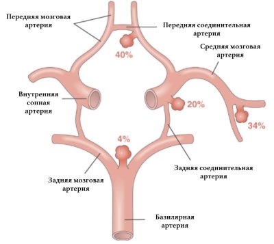 Расширение яремной вены на шее симптомы, причины и лечение