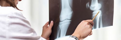 Разрыв передней крестообразной связки коленного сустава лечение