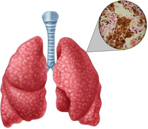 Туберкулез простаты причины, симптомы и лечение туберкулеза предстательной железы