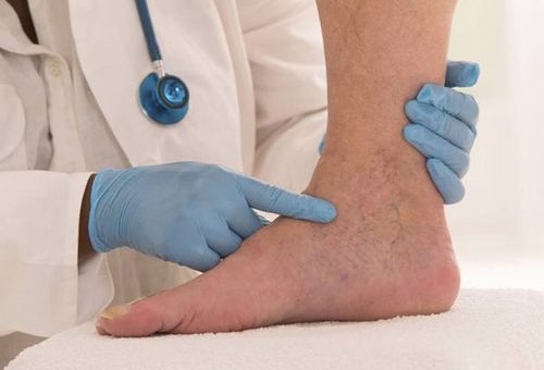 Тяжесть и боль в ногах причины возникновения, диагностика в тюмене