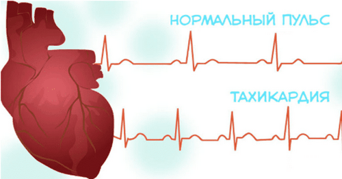 Учащенное сердцебиение причины, симптомы и способы лечение