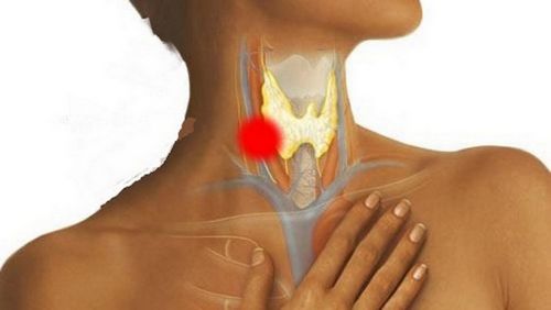 Что делать, если горло начинает болеть первые признаки и методы их устранения