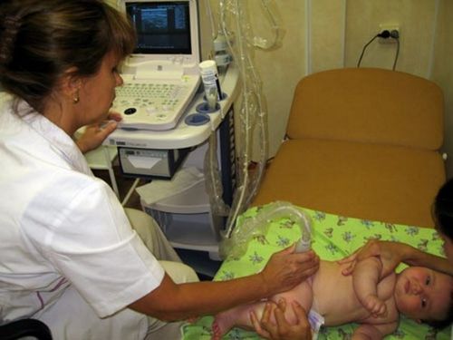 Рентген тазобедренных суставов у детей норма, расшифровка, патология