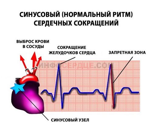 Синусовый ритм сердца на экг - что это значит в диагностике кардиопатологий