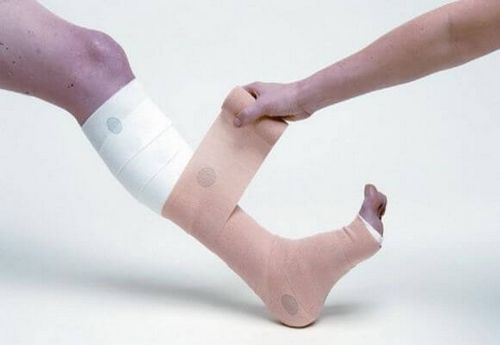 Рекомендации как правильно бинтовать ногу эластичным бинтом при варикозе