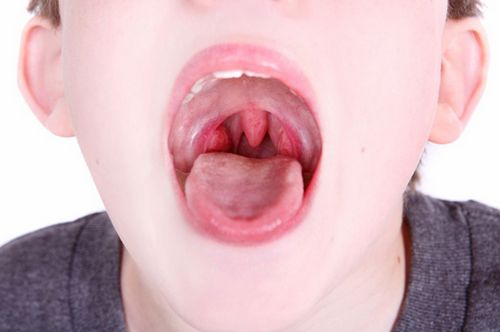 У ребенка болит горло средства от боли в горле