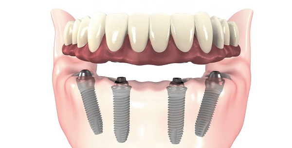 Разница между ортодонтом и ортопедом