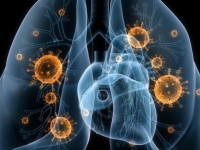 Спалах вірусної пневмонії: три пацієнта померли