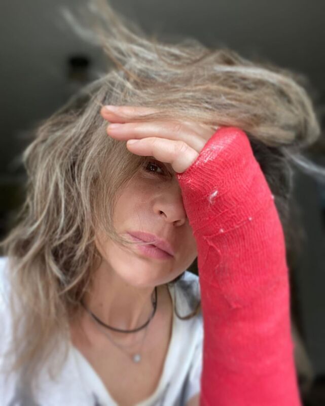 52-летняя Оксана Фандера травмировала руку