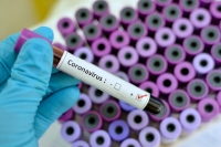 Розроблено українські тест-системи для діагностики коронавірусу COVID-19