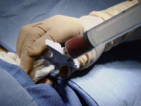 Прорыв в отечественной трансплантологии: доноров костного мозга можнож искать в мировом реестре