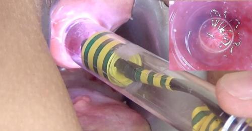 Peehole play urethral sounding endoscope [HD, 720p] [Stim99.com]
