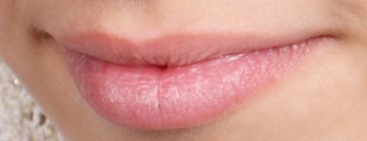 Если губы сохнут летом — лучшие варианты увлажнения