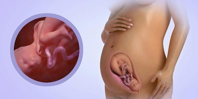 Беременность 29 недель – развитие плода и ощущения женщины