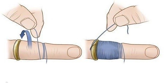 Как снять кольцо с помощью нитки