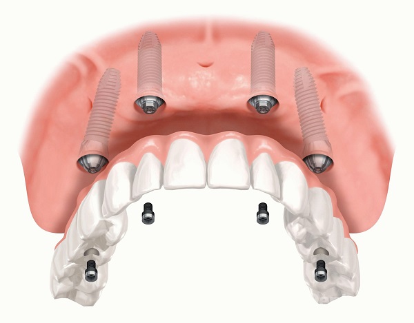 Разница между ортодонтом и ортопедом