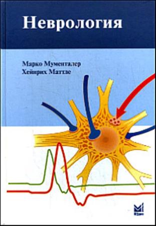Марко Мументалер, Хейнрих Маттле - Неврология (2007)